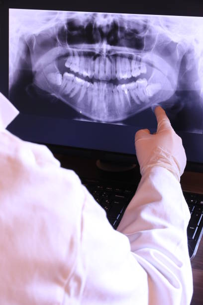 Best Emergency Wisdom Teeth Removal in Kyle, TX