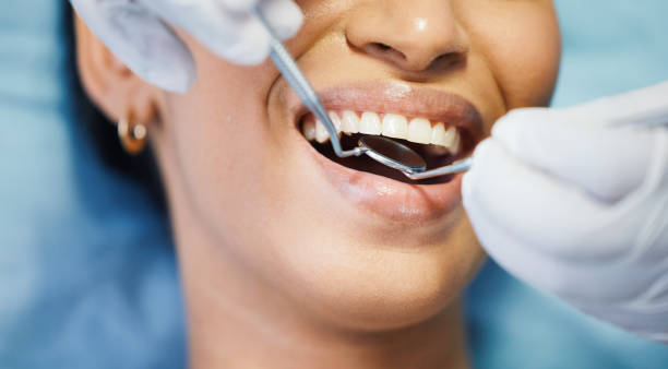 Best Emergency Treatment for Toothache in Kyle, TX